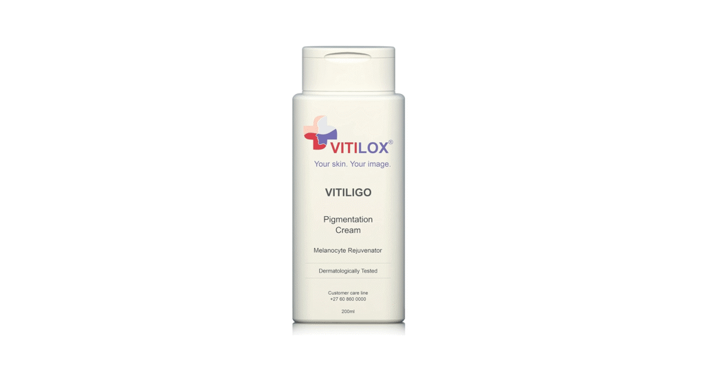 Vitilinox